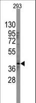 Polyclonal Rabbit anti-Human SOX2 Antibody (aa89-119, IHC, IF, WB)