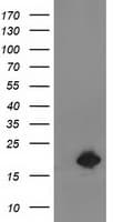 DSTN / Destrin Antibody (clone OTI2F7)