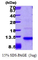 Human CCL26 / Eotaxin 3 Protein (Recombinant)