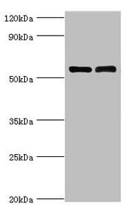 Polyclonal Rabbit anti-Human IL7R / CD127 Antibody (aa21-239, IHC, WB)
