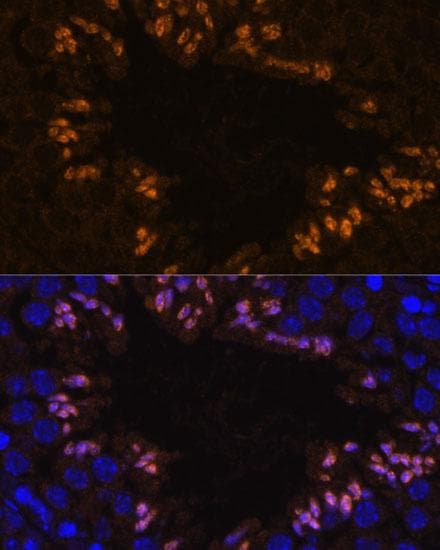 ELSPBP1 / HE12 Antibody