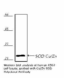 IHC-plus™ SOD1 / Cu-Zn SOD Antibody