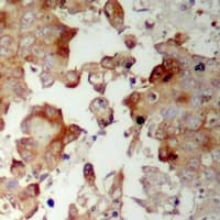 MRPS17 Antibody (N-Terminus)