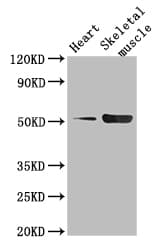 TPH1 / Tryptophan Hydroxylase Antibody