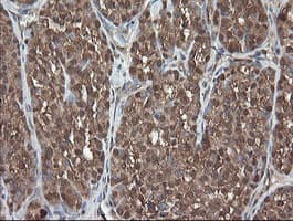Monoclonal Mouse anti-Human PNPO Antibody (clone OTI1G9, IHC, WB)