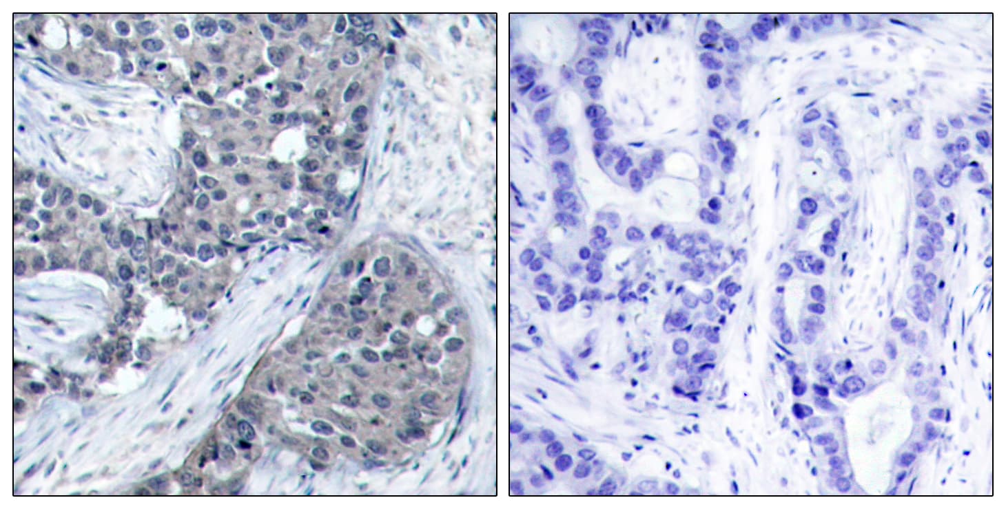 EIF4E Antibody (phospho-Ser209)