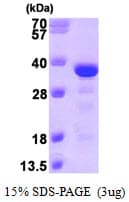 Human MAPRE3 / EB3 Protein (Recombinant His)