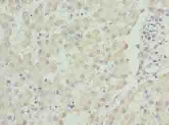 Polyclonal Rabbit anti-Human LACE1 Antibody (IHC, WB)