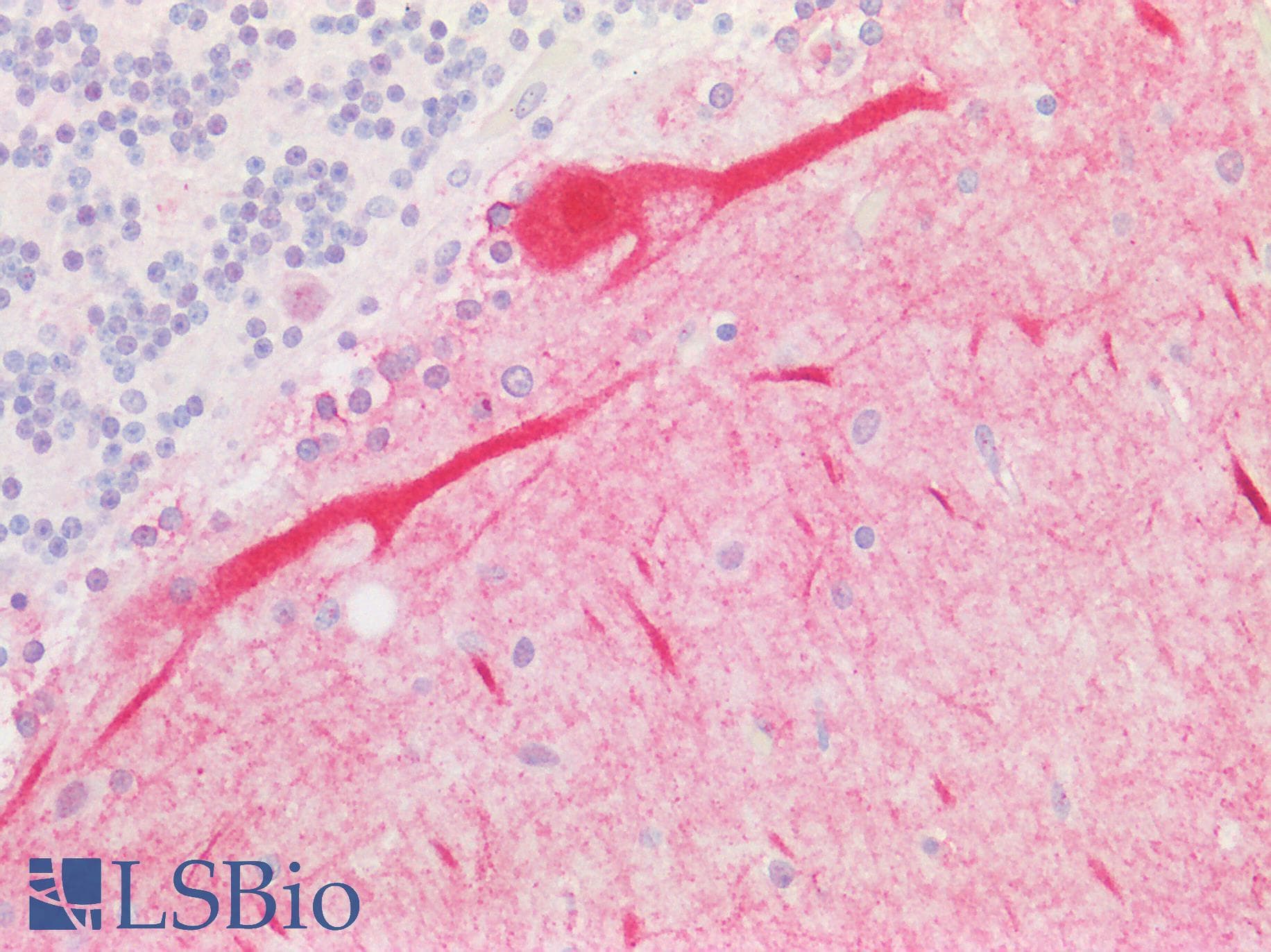 GCS1 / MOGS Antibody (aa144-193)