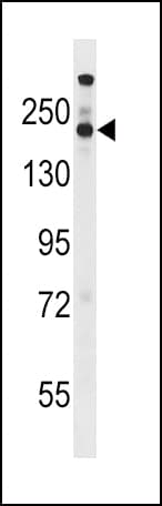 STAG1 / SA1 Antibody (aa540-568)