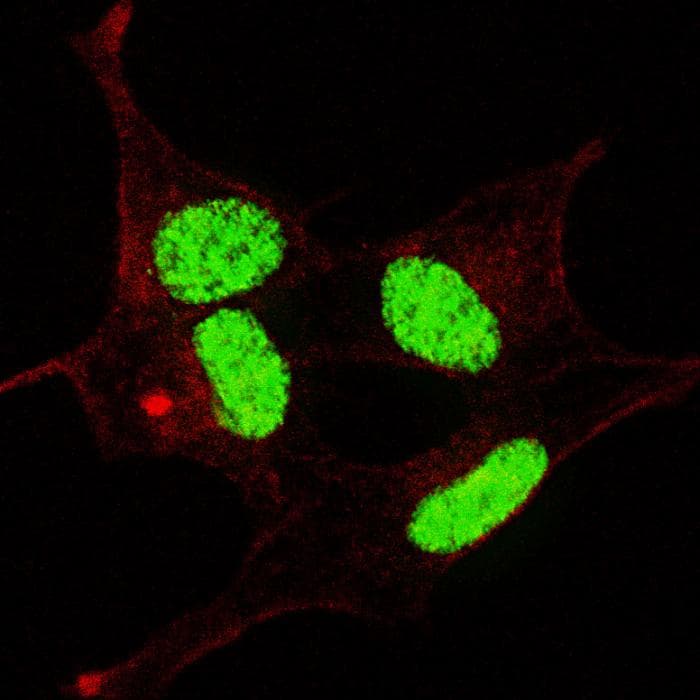 LIN28A / LIN28 Antibody (phospho-Ser134)