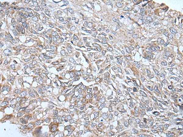 ETFB Antibody