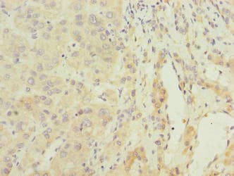 ARMCX2 Antibody