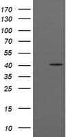 IHC-plus™ ACAA2 Antibody (clone 1C10)