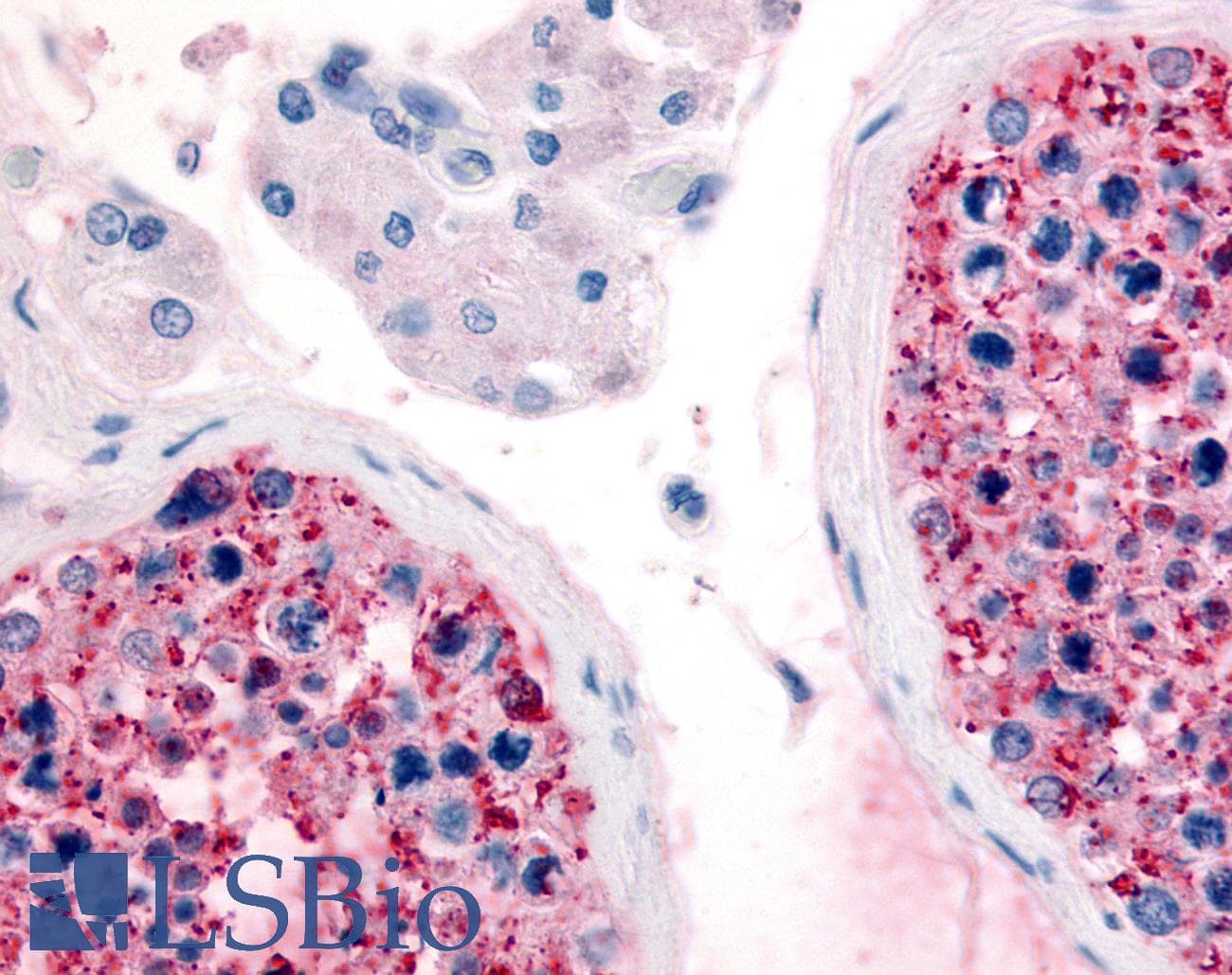IHC-plus™ Polyclonal Rabbit anti-Human FZD9 / Frizzled 9 Antibody (Extracellular Domain, IHC)