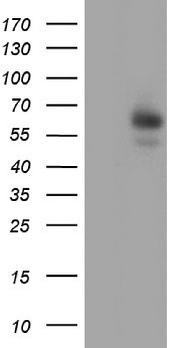 IHC-plus™ AMY2A / Pancreatic Amylase Antibody (aa135-408, clone 1E3)