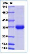 Zika Virus Membrane Protein (Recombinant Human IgG Fc, C-terminus)