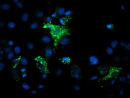 MIPEP Antibody (aa174-516, clone OTI5E7, Carrier-free)