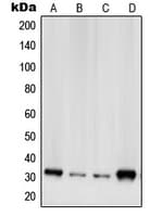 RPS2 / Ribosomal Protein S2 Antibody (C-Terminus)