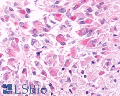 PathPlus™ Polyclonal Rabbit anti-Human FKSG80 / GPR81 Antibody (Extracellular Domain, IHC)
