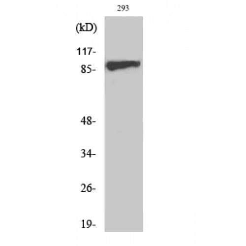 IGF1R / IGF1 Receptor Antibody (1100-1180 aa)