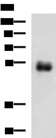 Polyclonal Rabbit anti-Human METT11D1 Antibody (IHC, WB)