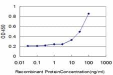 IHC-plus™ DLD / Diaphorase / E3 Antibody (clone 2D4)