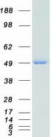 Human IDH1 / IDH Protein (Recombinant Myc-DDK (Flag))