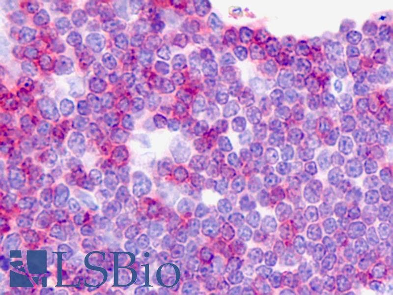 PathPlus™ Monoclonal Rat anti-Human CD3 Antibody (clone CD3-12, IHC, WB)