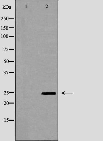 PYCARD / ASC / TMS1 Antibody