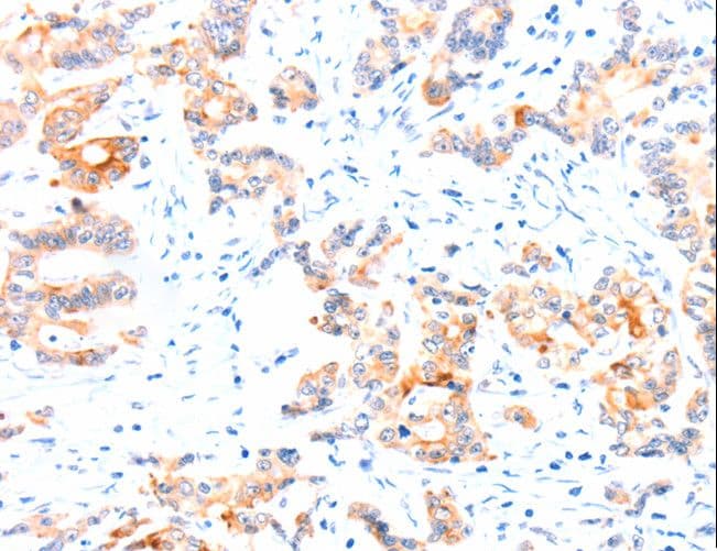 CCDC88A / GIV / Girdin Antibody