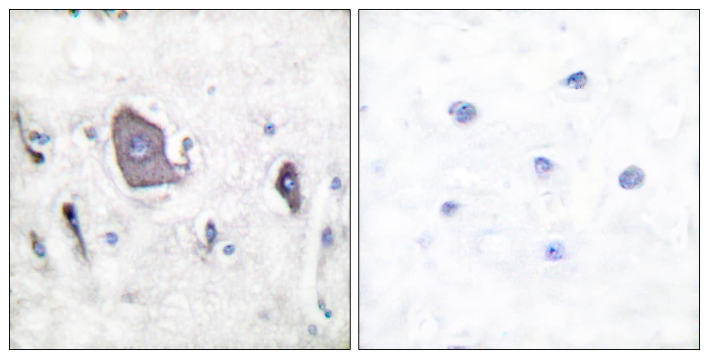 NTRK2 / TRKB Antibody (phospho-Tyr705)