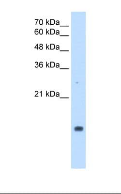 PPIA / Cyclophilin A Antibody (C-Terminus)