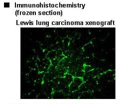Polyclonal Rabbit GLB1 / Beta-Galactosidase Antibody (IHC, WB)