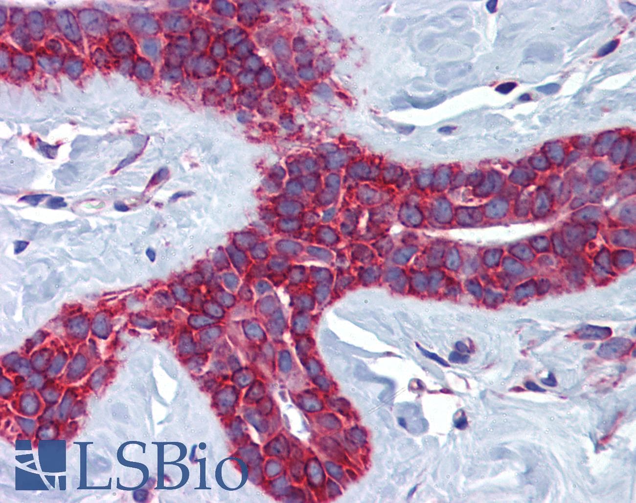 PathPlus™ Polyclonal Rabbit anti-Human CTSV / Cathepsin V Antibody (aa95-144, IHC, WB)