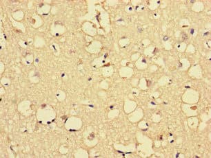 ARHGDIG / RHOGDI-3 Antibody