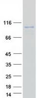 Human DPP6 / Dipeptidylpeptidase 6 Protein (Recombinant Myc-DDK (Flag))