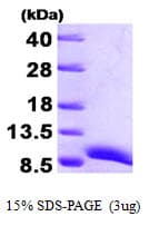 Human ATOX1 Protein (Recombinant His)
