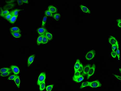 Polyclonal Rabbit anti-Human DEPDC2 Antibody (IHC, IF, WB)