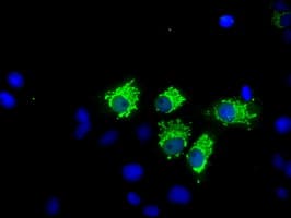 NIT1 Antibody (clone OTI3A11)