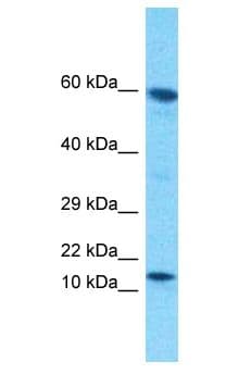 Polyclonal Rabbit anti-Human ATAD4 Antibody (aa54-103, WB)