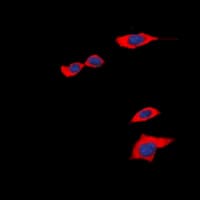 IHC-plus™ Prostaglandin D2 Receptor Antibody (C-Terminus)