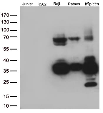 Monoclonal Mouse anti-Human CD74 / CLIP Antibody (clone UMAB232, IHC, WB)