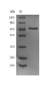 Rat SERPINA1 / Alpha 1 Antitrypsin Protein (Recombinant 6His, N-terminus)