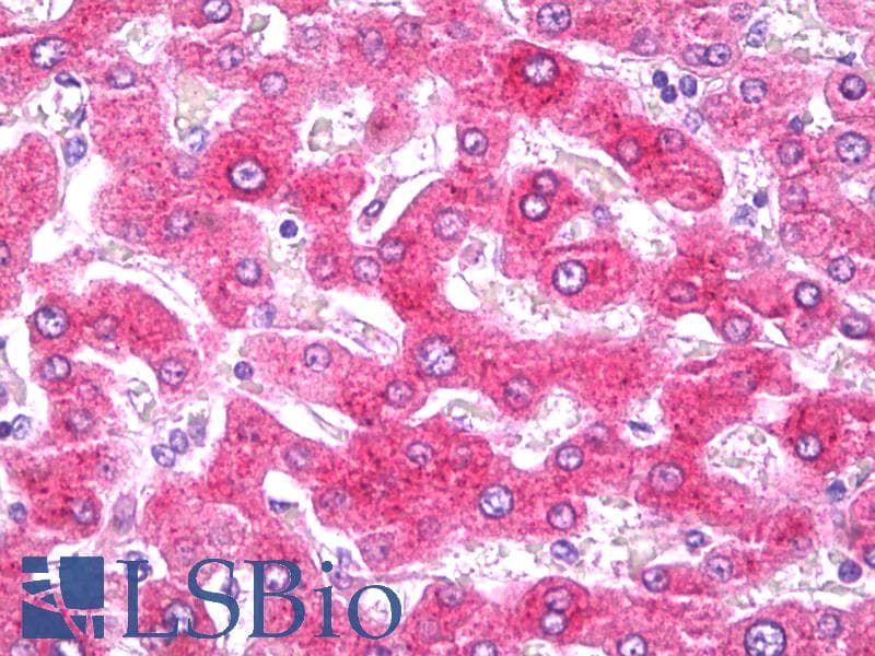 PathPlus™ CRP / C-Reactive Protein Antibody