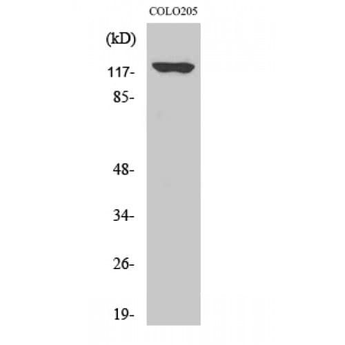 Polyclonal Rabbit anti-Human ADCY1 / Adenylate Cyclase 1 Antibody (200-280 aa, Internal, IHC, WB)