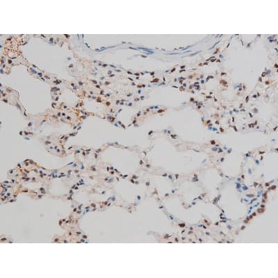 GATA1 Antibody (phospho-Ser142)