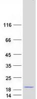 Human MORN4 Protein (Recombinant Myc-DDK (Flag))