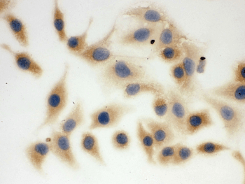 FASN / Fatty Acid Synthase Antibody