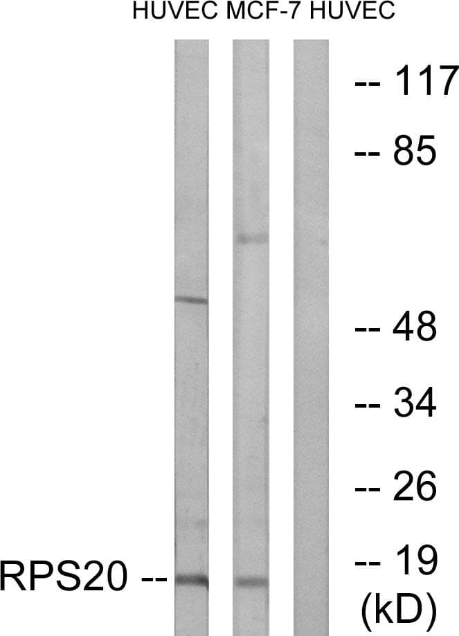RPS20 / Ribosomal Protein S20 Antibody